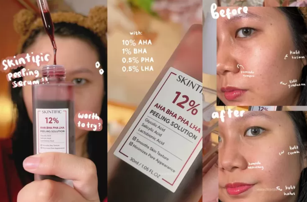 Bedah Strategi Bisnis Skintific Rahasia Brand Skincare Ini Kuasai Pasar Indonesia